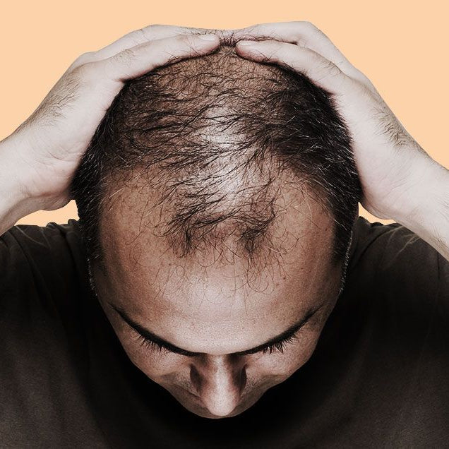 A Holistic Guide to Understanding and Combatting Hair Loss with Multivitamins